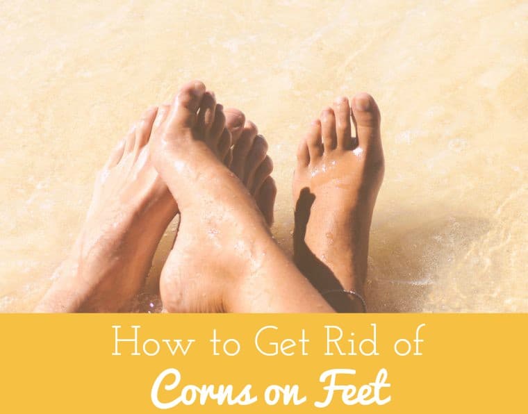 how to get rid of corn on feet