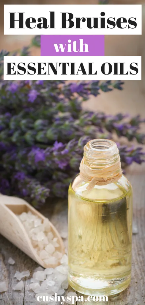 heal bruises with essential oils