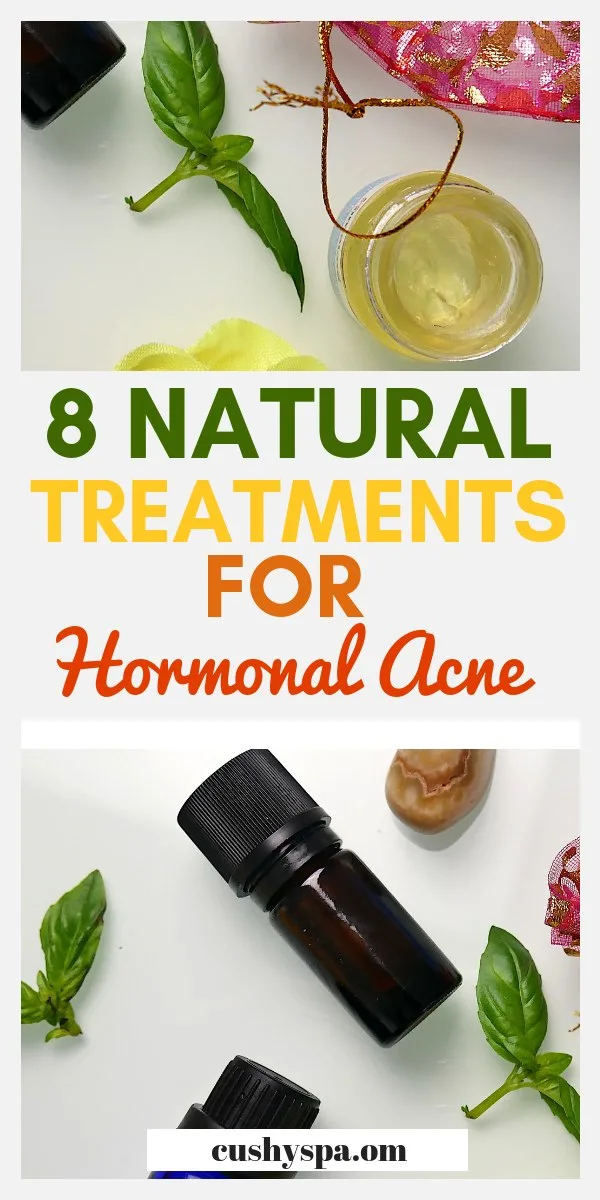 8 natural treatments for hormonal acne