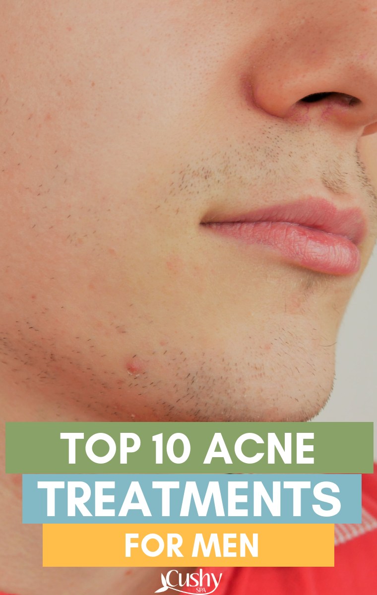 top 10 acne treatments for men